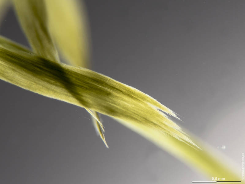 Aphanizomenon flos-aquae