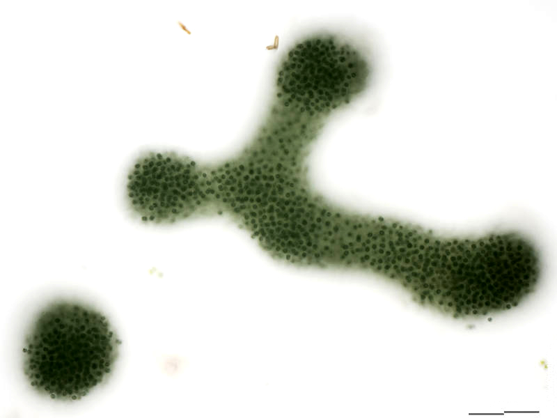 Microcystis aeruginosa