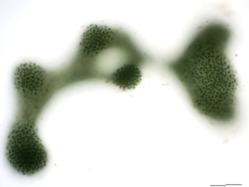 Microcystis aeruginosa