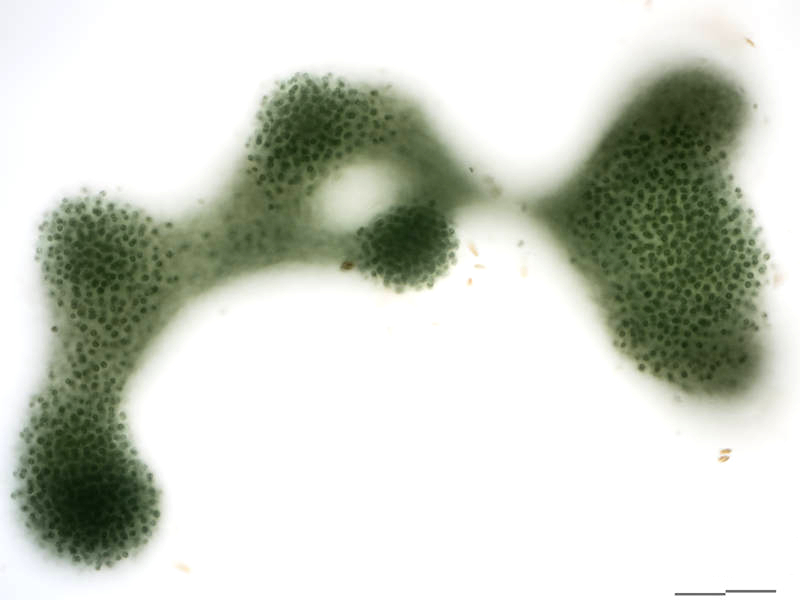 Microcystis aeruginosa