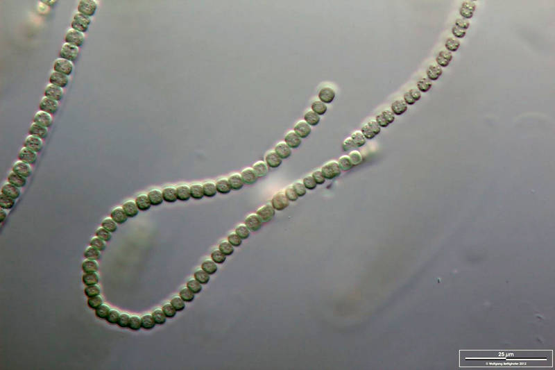 Nostoc communae