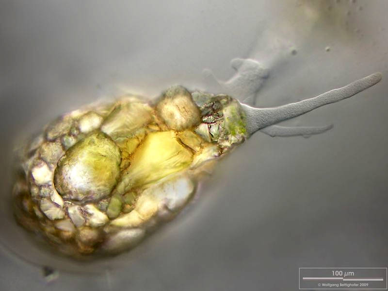 Difflugia pyriformis