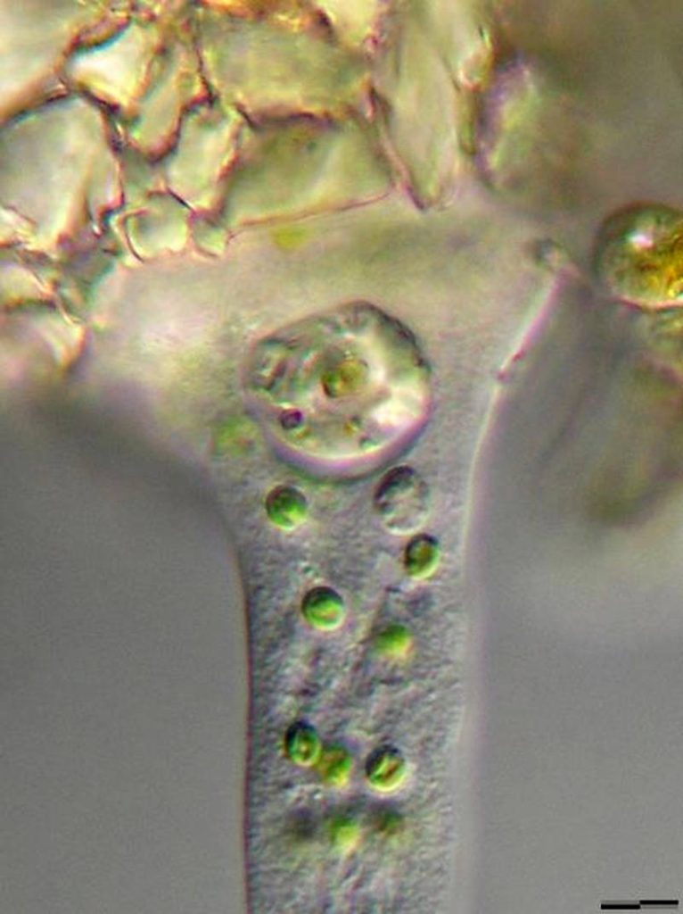 Difflugia pyriformis