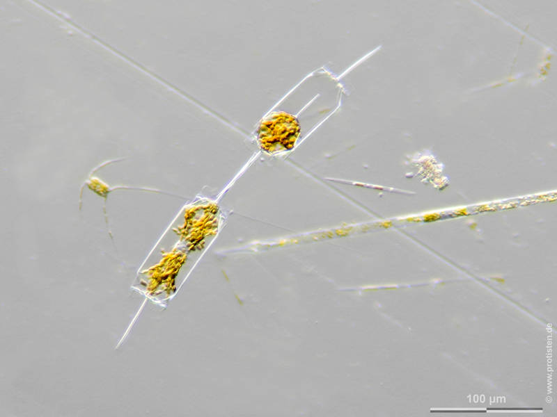 Ditylum brightwellii