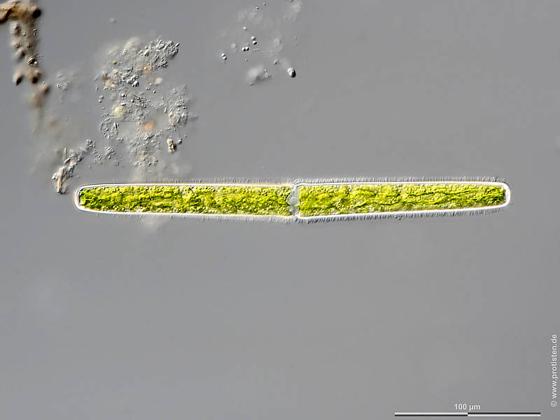 Pleurotaenium trabecula