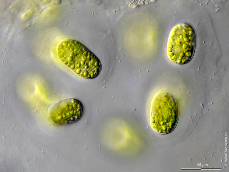 Mesotaenium chlamydosporum