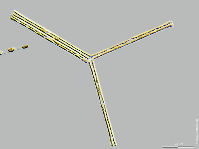 Asterionella tekelili