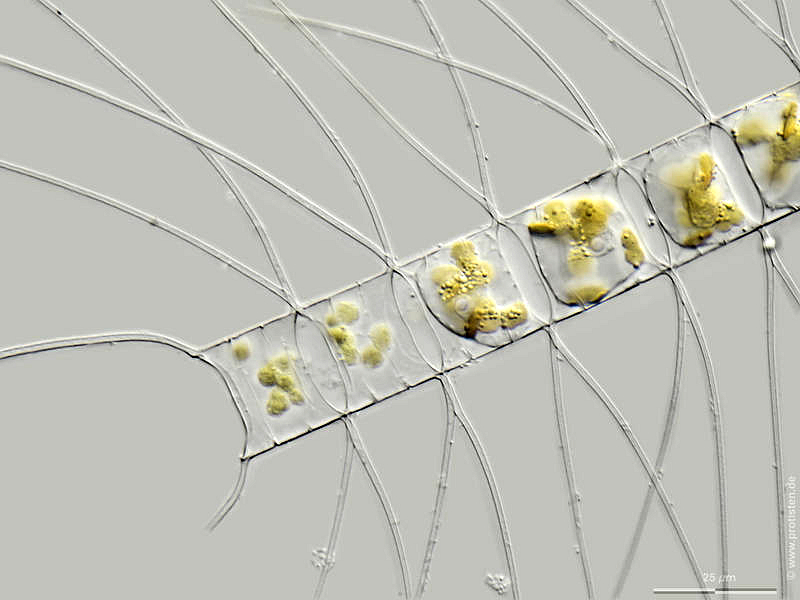 Chaetoceros decipiens