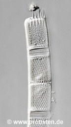 Aulacoseira granulata