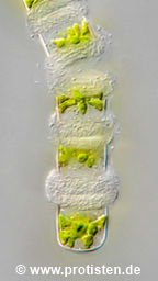 Hyalotheca mucosa var. laevicincta