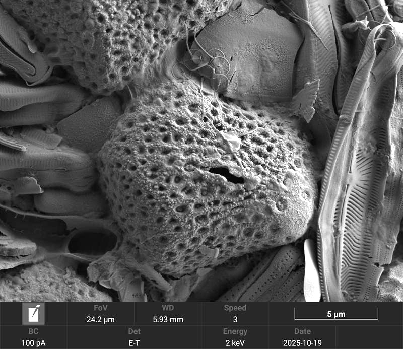 Difflugia brevicolla