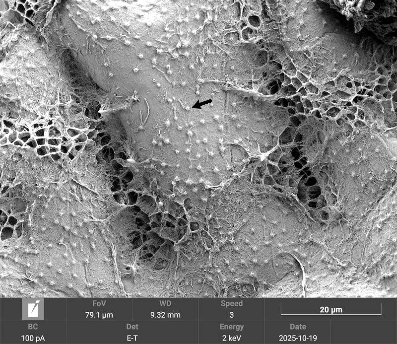 Micrasterias fimbriata