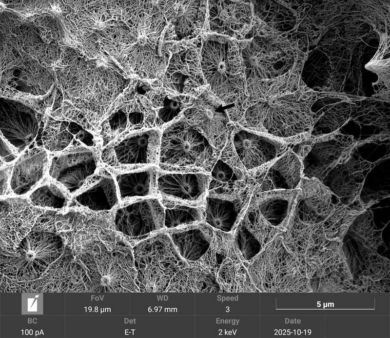 Micrasterias fimbriata