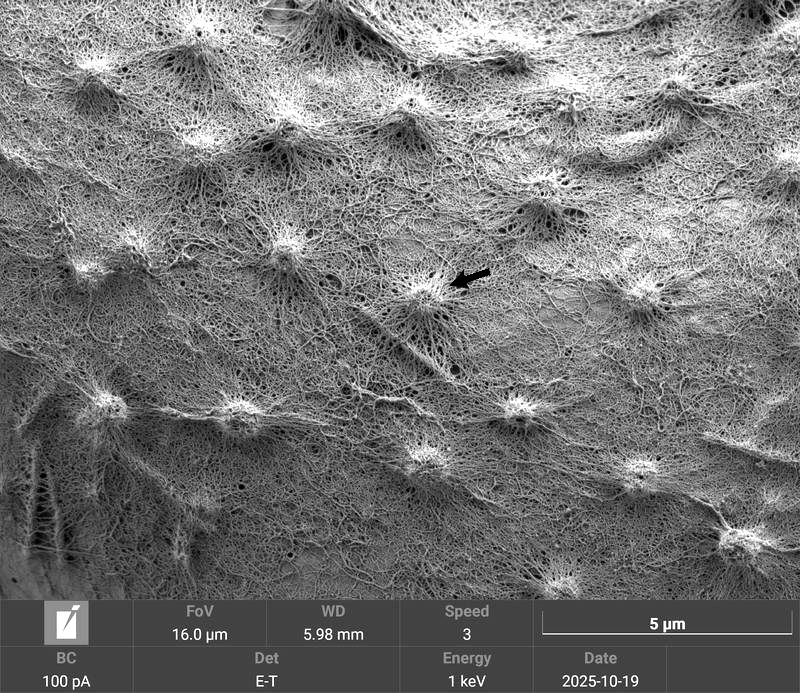 Micrasterias fimbriata