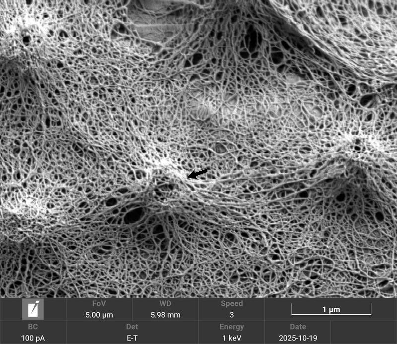 Micrasterias fimbriata