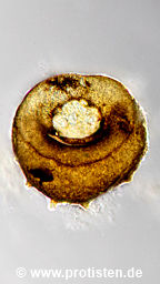 Centropyxis discoides