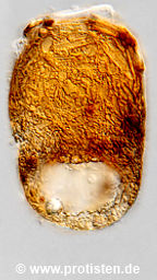 Centropyxis elongata