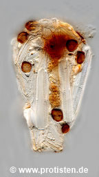 Difflugia bacillifera