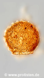 Difflugia brevicolla