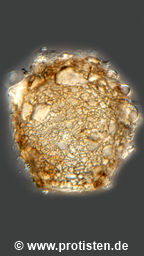 Difflugia globularis