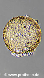 Difflugia lebes var. masurica