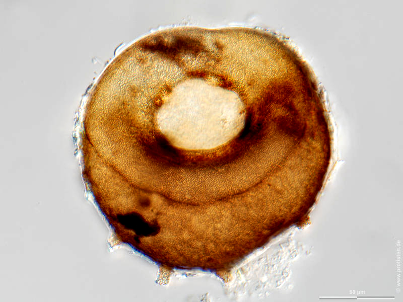 Centropyxis discoides