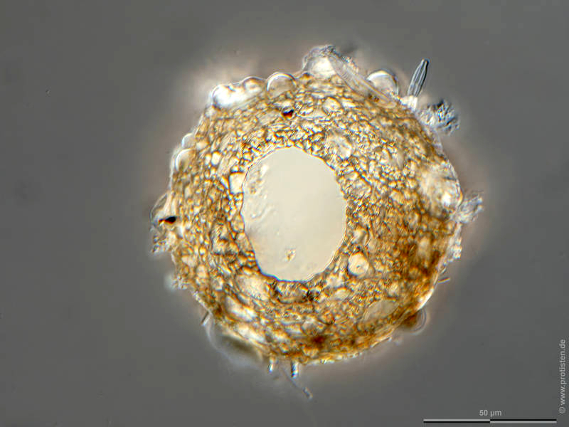 Difflugia globularis