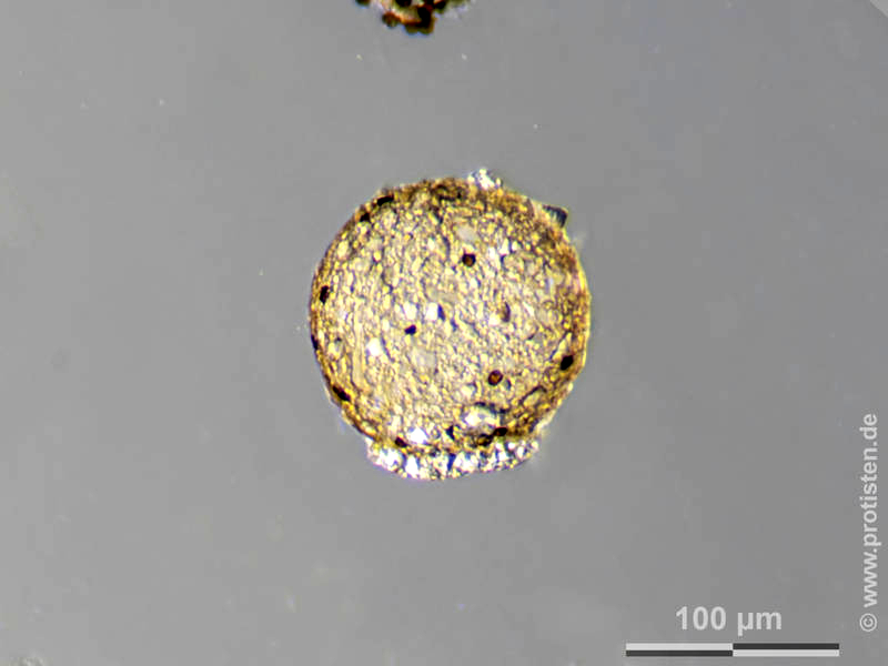 Difflugia lebes var. masurica