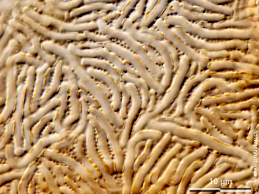 Lesquereusia spiralis