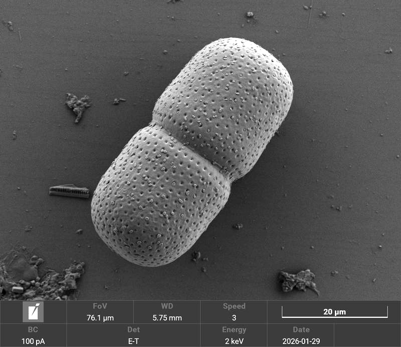 Actinotaenium cucurbita