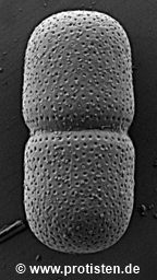 Actinotaenium cucurbita