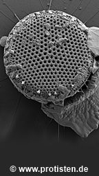 Thalassiosira leptopus