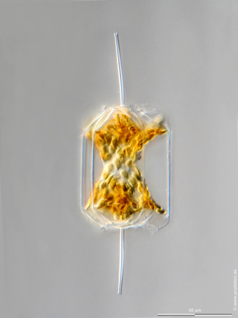 Ditylum brightwellii f. trigonum