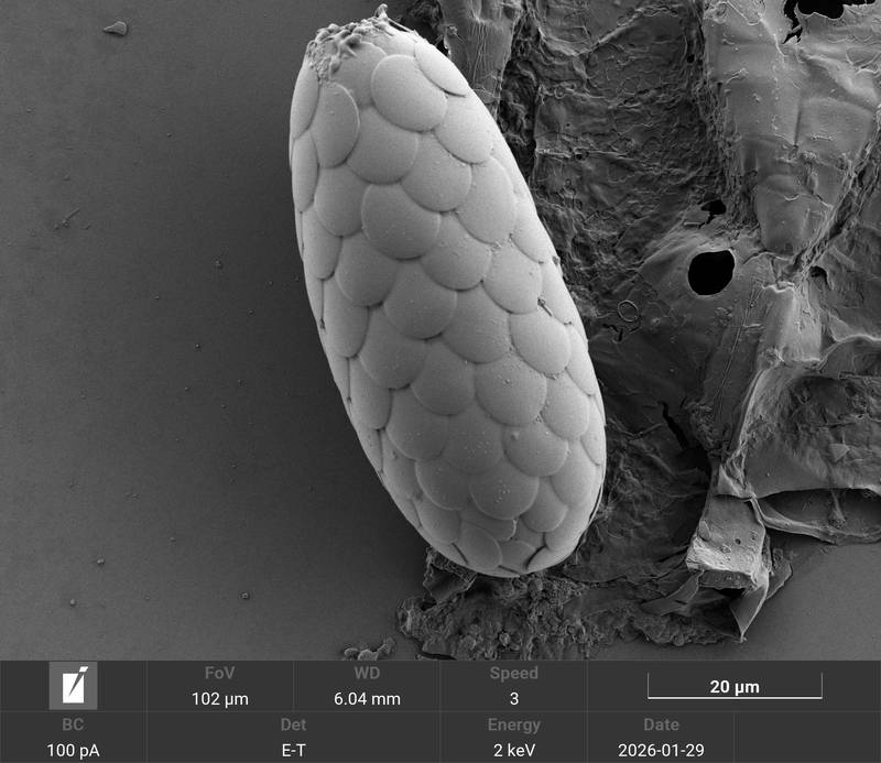 Tracheleuglypha elongata