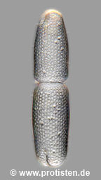 Tetmemorus brebissonii