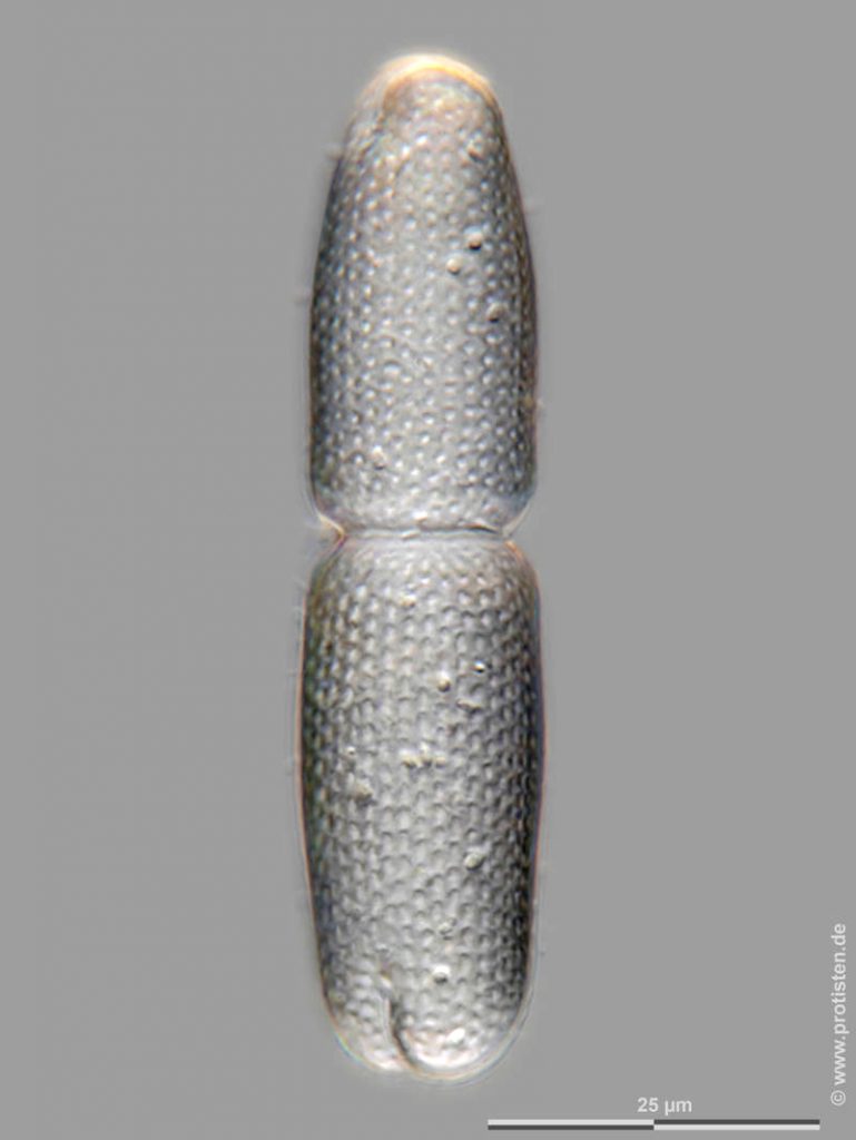 Tetmemorus brebissonii