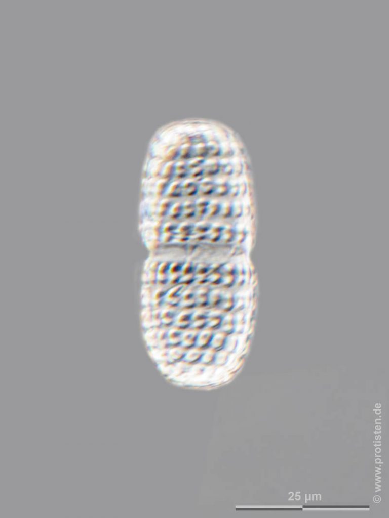 Cosmarium elegantissimiforme