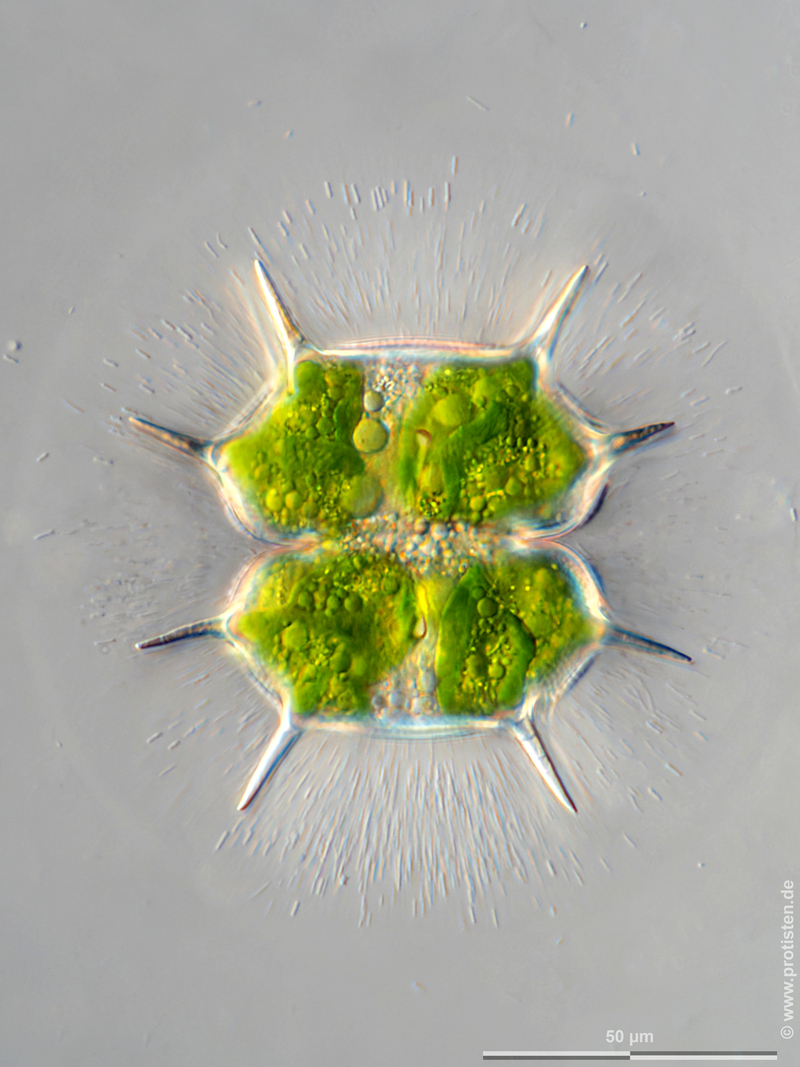 Xanthidium basiornatum