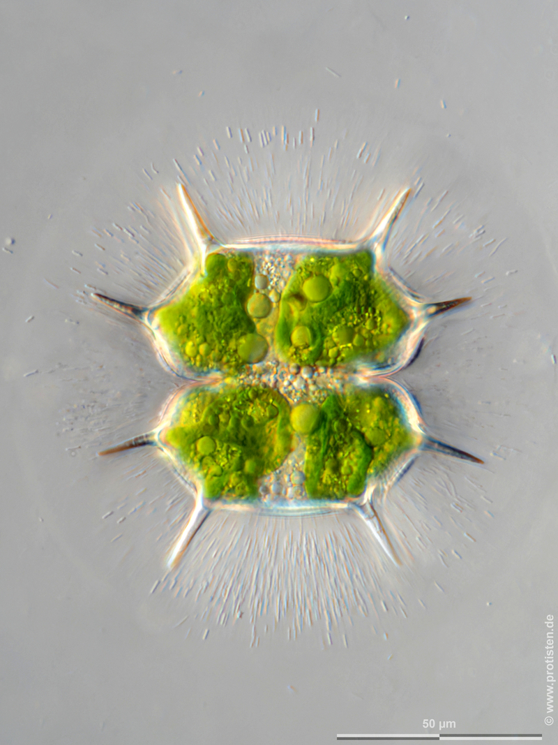 Xanthidium basiornatum