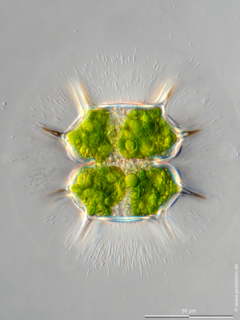 Xanthidium basiornatum