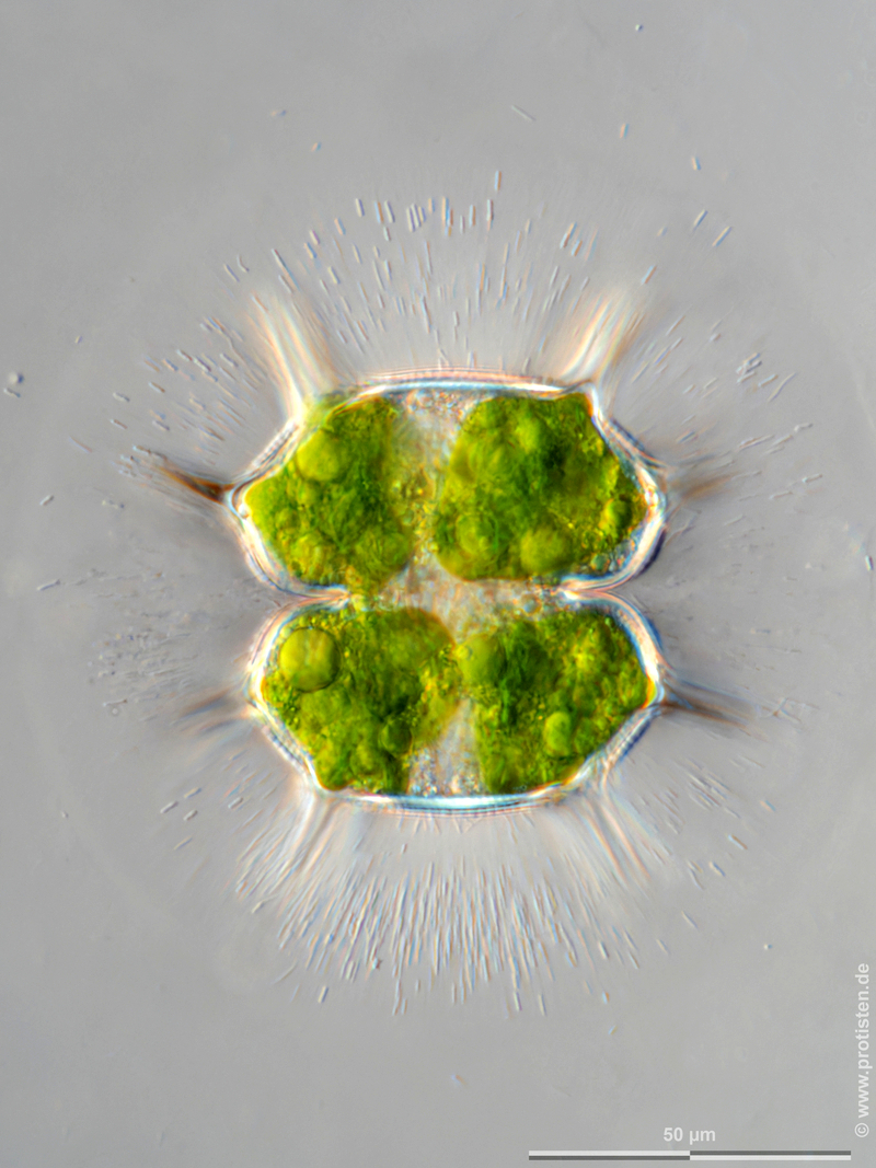 Xanthidium basiornatum