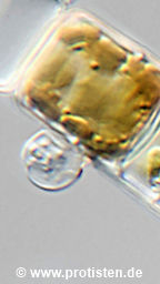 Chitrid on Melosira varians