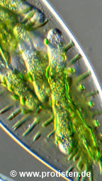 Fungal parasite in Netrium digitus