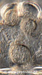 Parasite cyst in Euastrum ventricosum