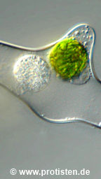 Parasite cyst in Mougeotia spec.