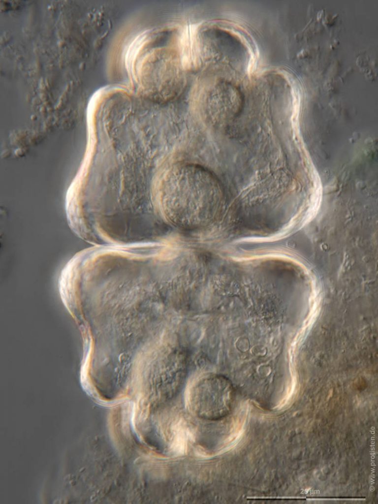 Parasite cysts in Euastrum ventricosum