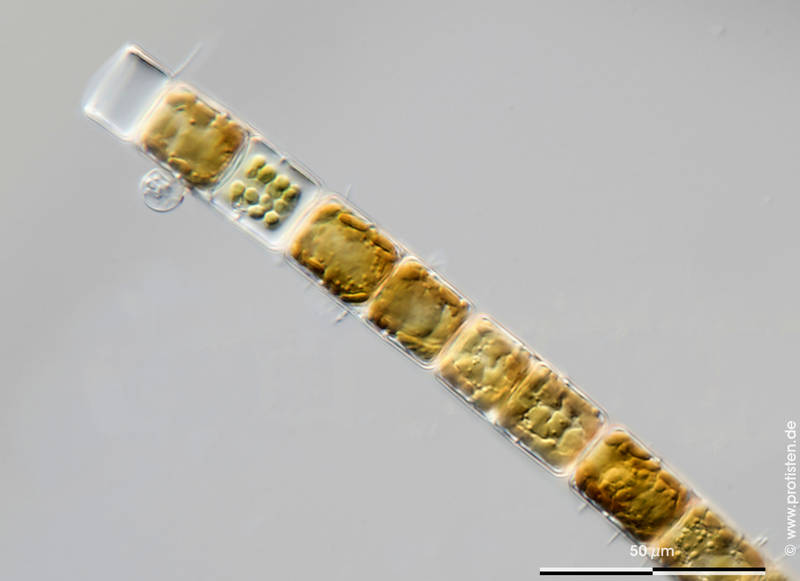 Chytrid on Melosira varians