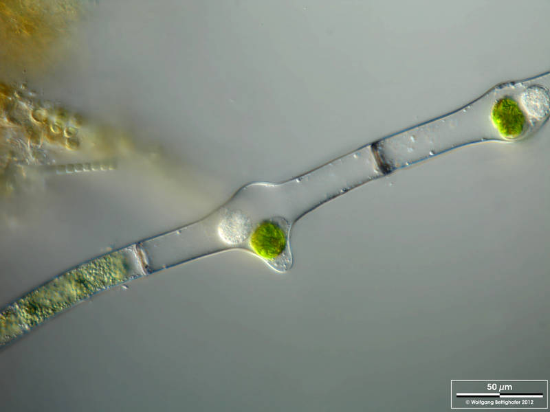 Parasite cysts in Mougeotia spec.