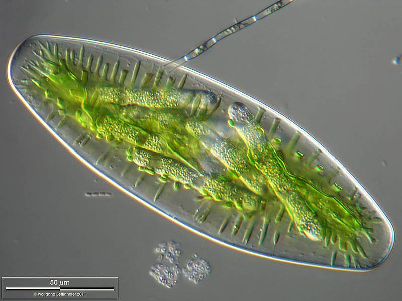 Fungal parasite in Netrium digitus