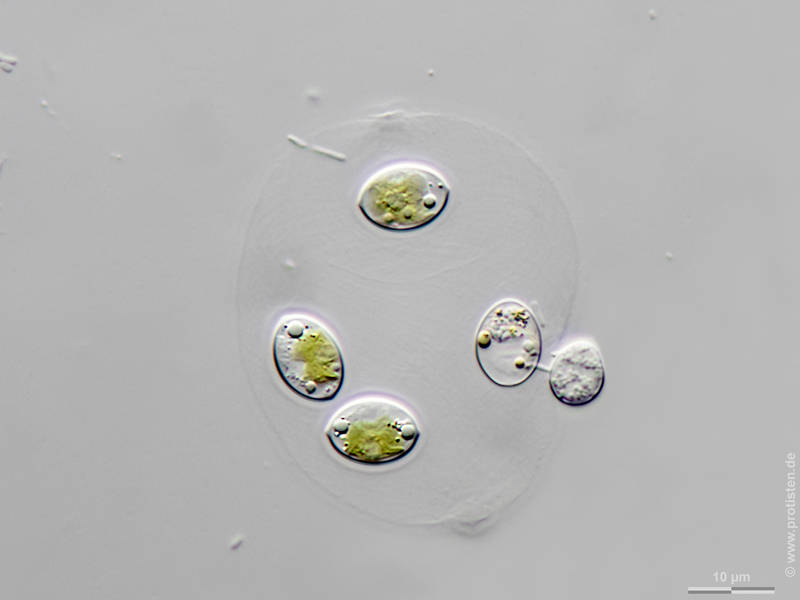 Chytrid on Oocystis lacustris